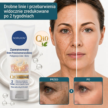 🔥 NORUION® Q10 x Roślinne Nano Egzosomy Zaawansowany krem przeciwzmarszczkowy