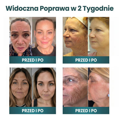 🔥 NORUION® Q10 x Roślinne Nano Egzosomy Zaawansowany krem przeciwzmarszczkowy