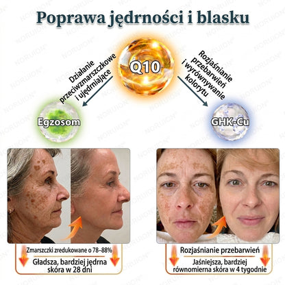 🔥 NORUION® Q10 x Roślinne Nano Egzosomy Zaawansowany krem przeciwzmarszczkowy