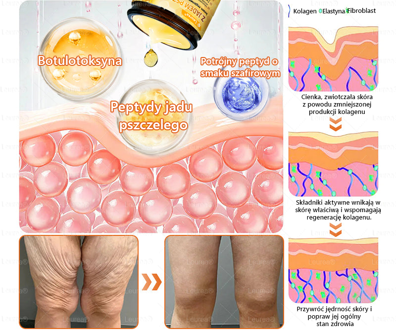 🎁💛🎁 Gratulacje! Dziś jesteś w gronie szczęśliwych klientów – otrzymujesz do 50% zniżki! Zadbaj o gładką, jędrną skórę i odzyskaj pewność siebie oraz urodę!