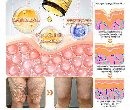 🎁💛🎁 Gratulacje! Dziś jesteś w gronie szczęśliwych klientów – otrzymujesz do 50% zniżki! Zadbaj o gładką, jędrną skórę i odzyskaj pewność siebie oraz urodę!