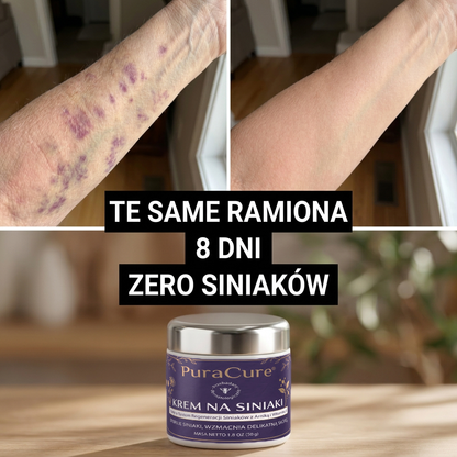 🍇Ponad 100 tys. sprzedanych sztuk 💁‍♀️ – PuraCure® Krem na regenerację siniaków i wzmocnienie skóry