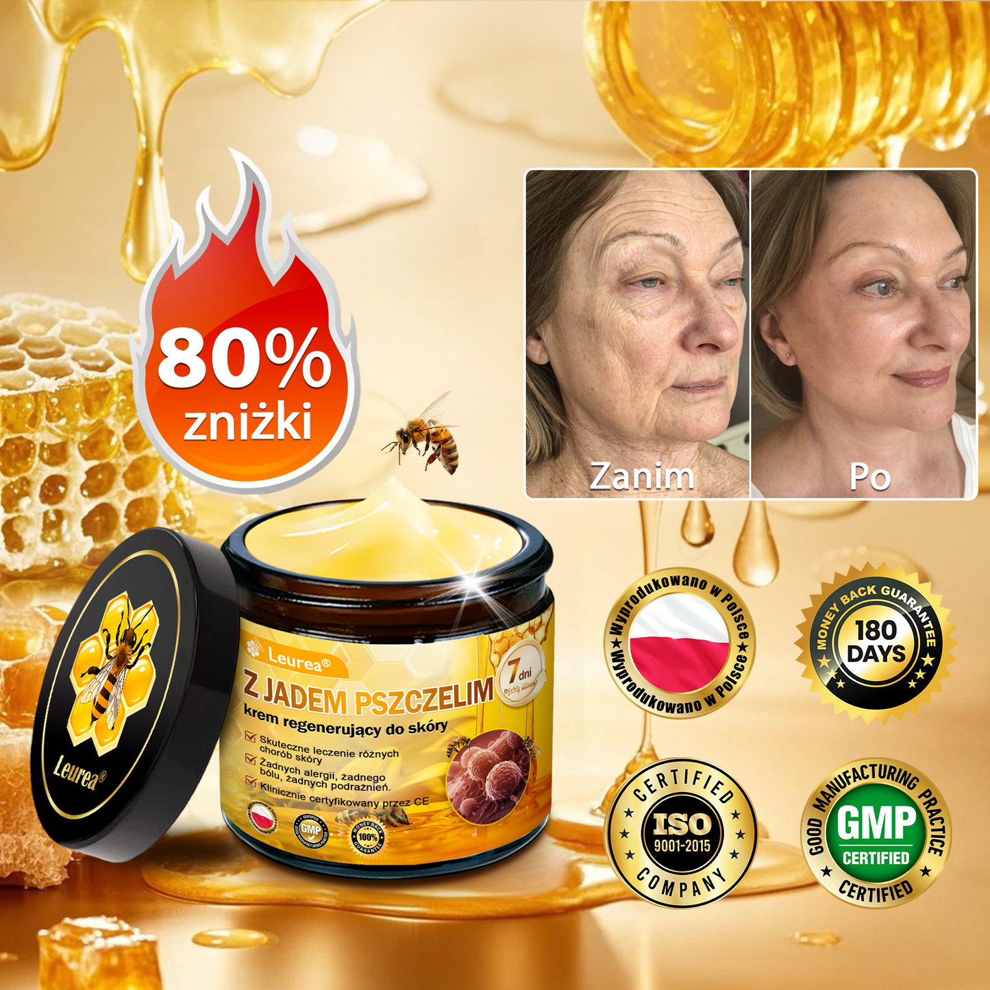 🎁💛🎁 Gratulacje! Dziś jesteś w gronie szczęśliwych klientów – otrzymujesz do 50% zniżki! Zadbaj o gładką, jędrną skórę i odzyskaj pewność siebie oraz urodę!