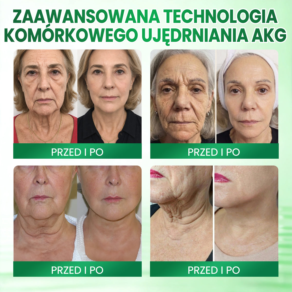 ✨✨Medistart® AKG Krem ujędrniający i przeciw oznakom starzenia – 💧 Jędrniejsza, gładsza i bardziej elastyczna skóra