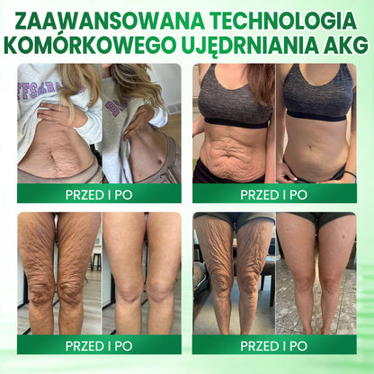 ✨✨Medistart® AKG Krem ujędrniający i przeciw oznakom starzenia – 💧 Jędrniejsza, gładsza i bardziej elastyczna skóra