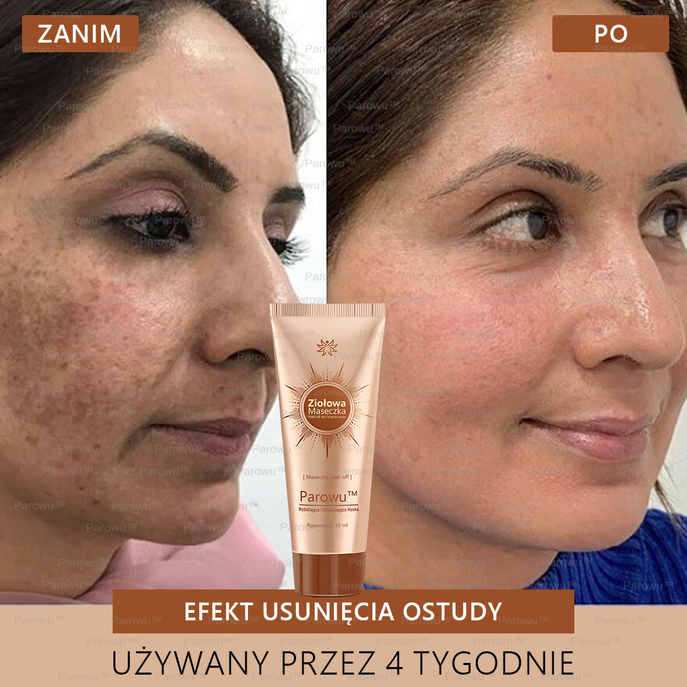 🌷Parowu™ Wybielająca i Rozjaśniająca Maska - Naturalne składniki trwale usuwają plamy, piegi i przebarwienia