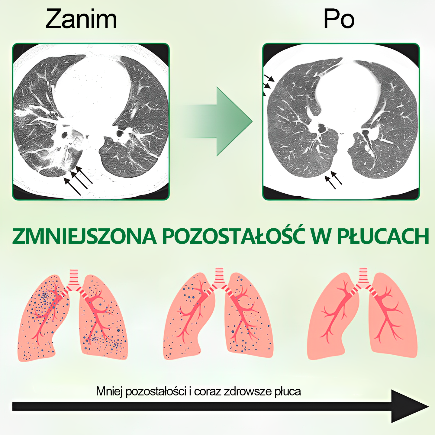 🌿🌿[Oficjalny Sklep Marki]𝐆𝐨𝐨𝐲𝐞𝐞𝐫™ Zaawansowany spray do oczyszczania płuc- ☘️Zdrowie płuc - wsparcie immunologiczne, detoksykacja i wsparcie oddechowe - wyprodukowane w Polsce