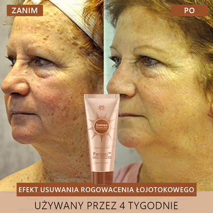 🌷Parowu™ Wybielająca i Rozjaśniająca Maska - Naturalne składniki trwale usuwają plamy, piegi i przebarwienia