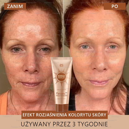 🌷Parowu™ Wybielająca i Rozjaśniająca Maska - Naturalne składniki trwale usuwają plamy, piegi i przebarwienia