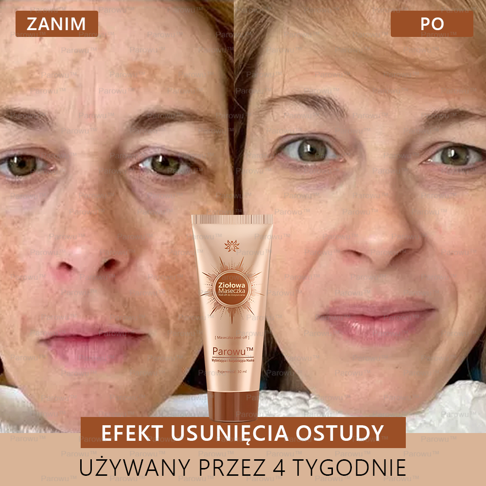 🌷Parowu™ Wybielająca i Rozjaśniająca Maska - Naturalne składniki trwale usuwają plamy, piegi i przebarwienia