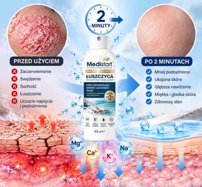 💧 Medistart® Specjalistyczny krem do pielęgnacji skóry z łuszczycą – ✅ Testowany dermatologicznie